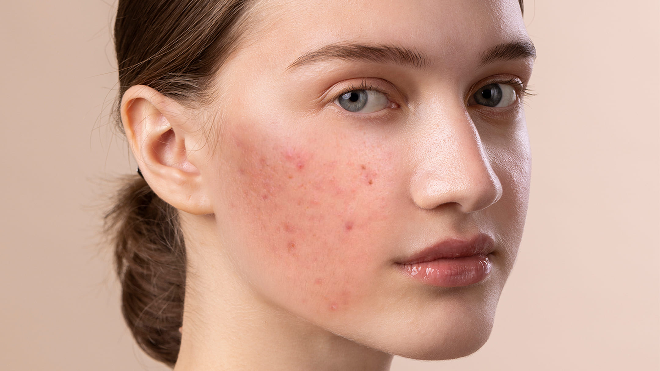 Before using natural products